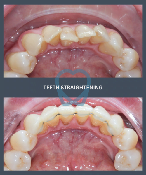 Before and after 10