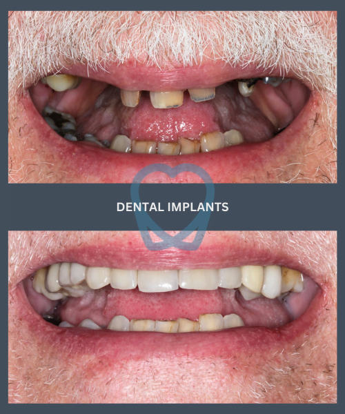 Before and after 5