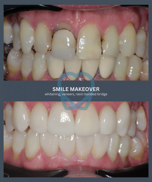 Before and after 6