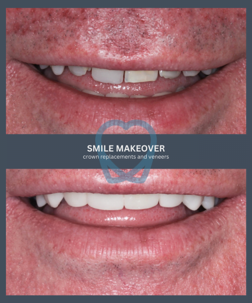 Before and after 7