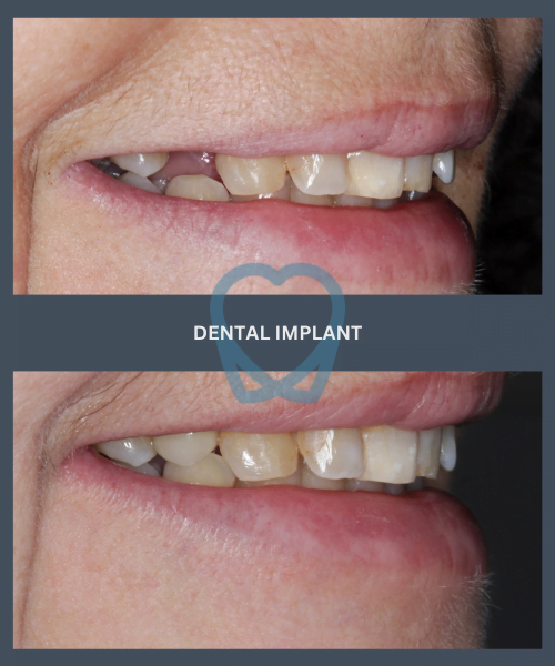 Before and after 8
