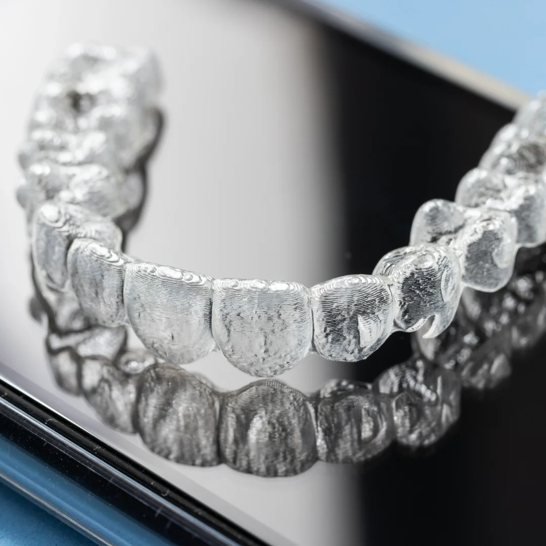 Description of Image