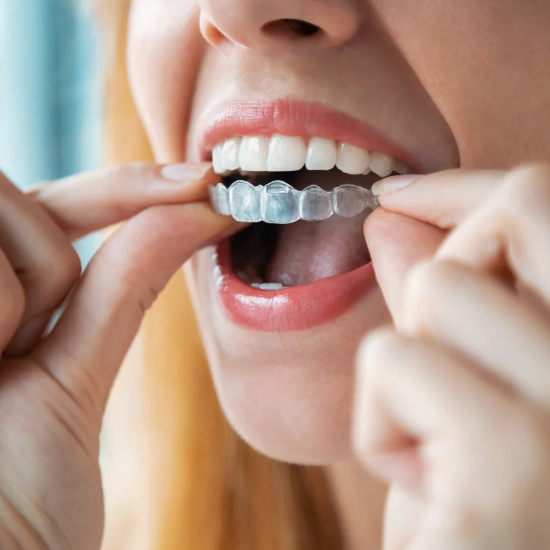 Description of Image